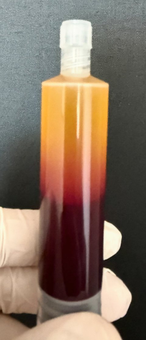 A syringe held in a gloved hand: amber plasma above a dark red layer