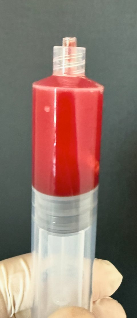 A syringe filled with red blood